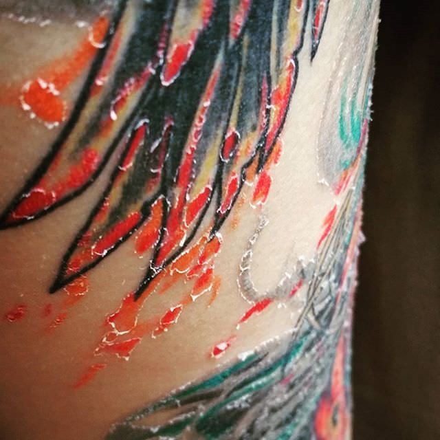 tattoo peeling